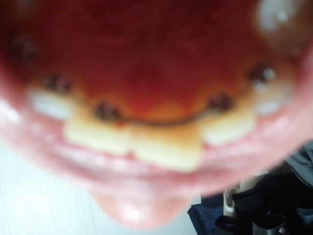 2011-04-15 20.09.33.jpg