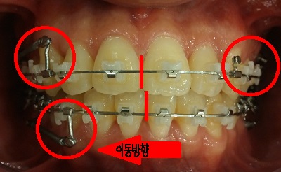 이동방향.jpg