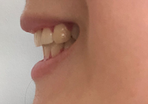 P20190323_154659170_CC4FBD0E-1913-46E2-99FE-6C132AE20427.jpg