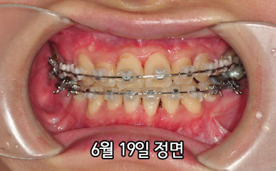 20150619jungh.jpg
