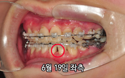 20150619lefth.jpg