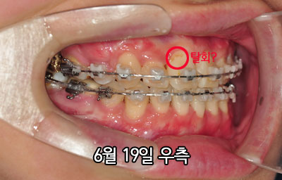 20150619righth.jpg