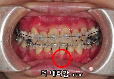 apni002(8월10일).gif
