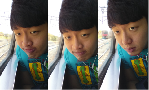 턱관절+교정후기7.png