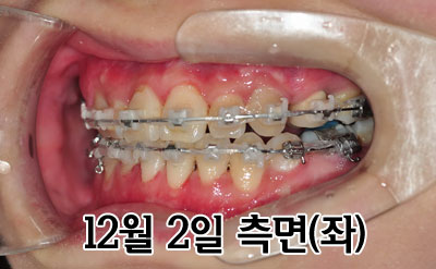 1202lefthhh.jpg