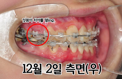 1202righthhh.jpg