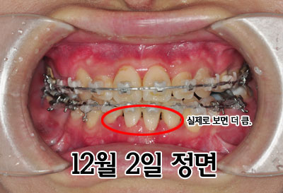 1202junghhh.jpg