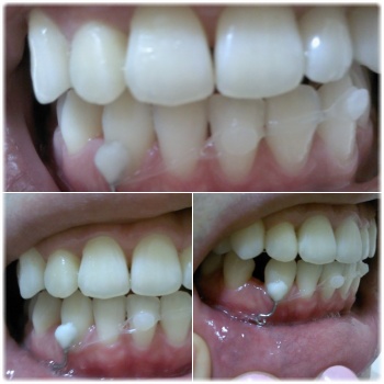 2011-09-08 00.00.18.jpg