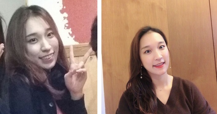 돌출입교정_39.jpg