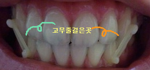 ㅇㅇㅇㅇ.jpg