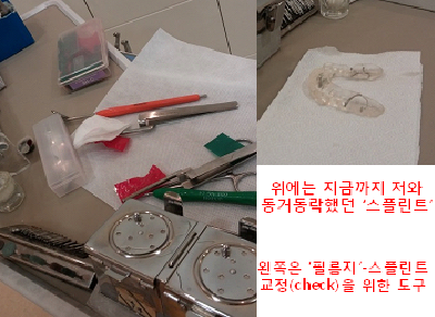 턱관절교정후기7화사진3.png