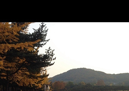 치아교정후기07.JPG
