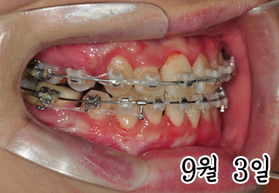 right0903h.jpg