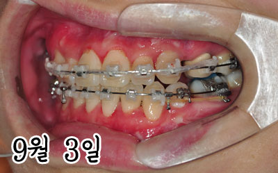 left0903h.jpg