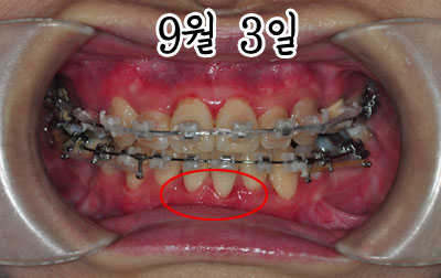 up0903h.jpg