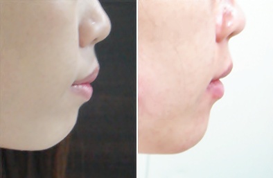 옆.jpg