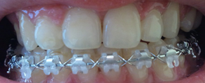 2011-09-08 08.42.54.jpg