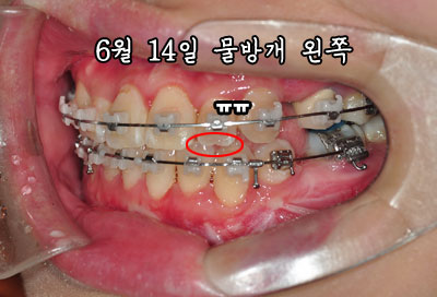 hleft0614.jpg