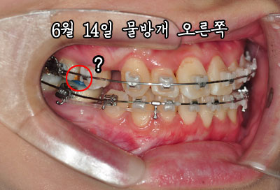 hright0614.jpg