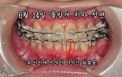 jung0614.jpg