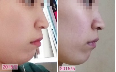 교정후기_9_1_.jpg