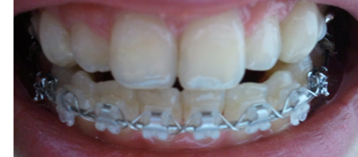 2011-01-24 09.59.09.jpg