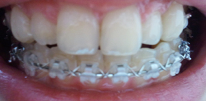 2011-01-24 10.00.26.jpg