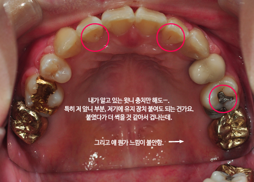 160802_upper_ham(1).png