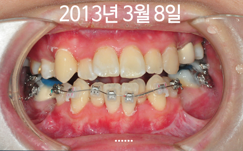 160802_str_ham(2).png