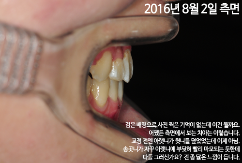160802_right_ham(1).png