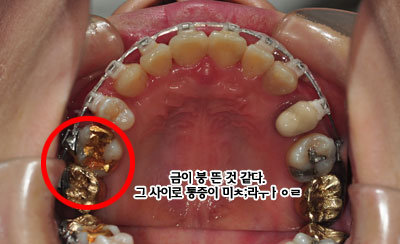 gold141030h.jpg