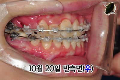 right141020h.jpg