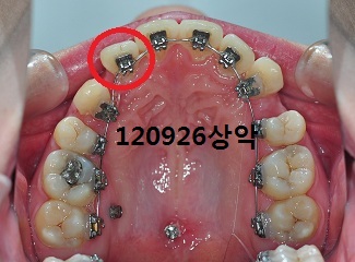 120926상악.jpg