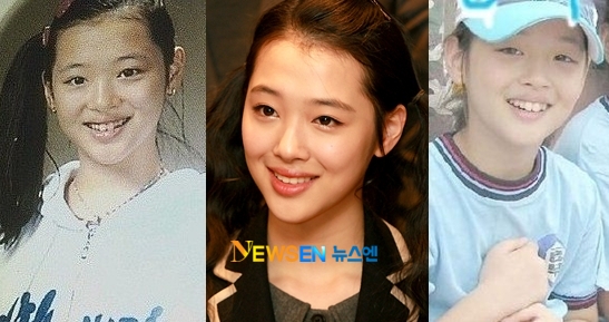 설리 앞니.jpg