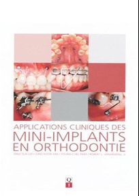 Applications cliniques des mini-implants en orthodontie (불어판) 표지