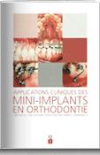 Applications cliniques des mini-implants en orthodontie 표지