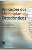 Aplicações dos Miniimplantes Ortodônticos 표지