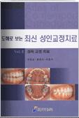 도해로 보는 최신 성인 교정 치료 Vol.Ⅱ 설측 교정 치료 표지