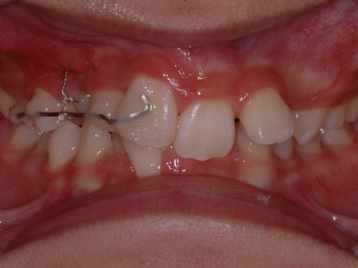 2012-08-16.jpg