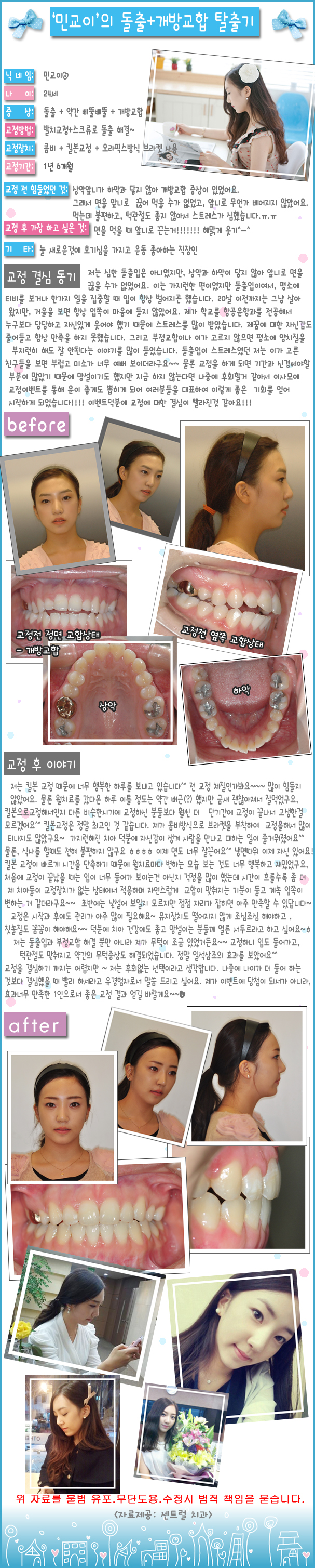 교정후기2.jpg