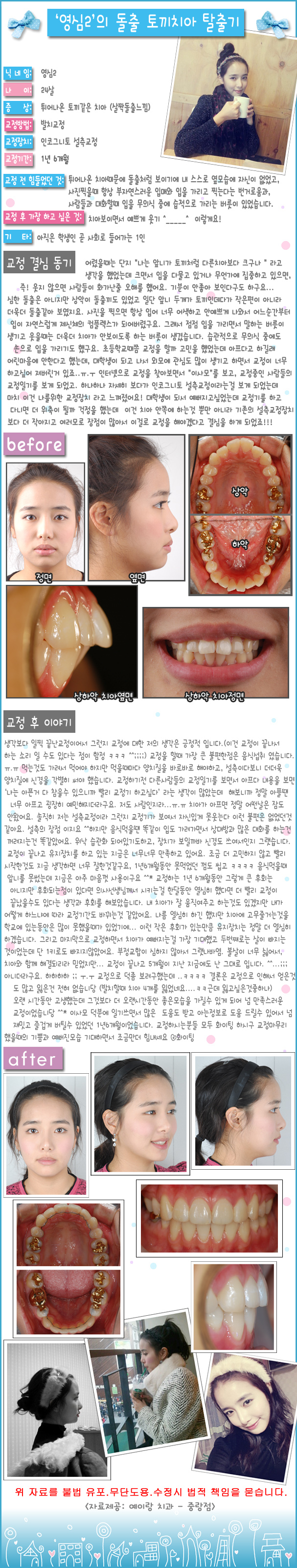 교정후기2.jpg