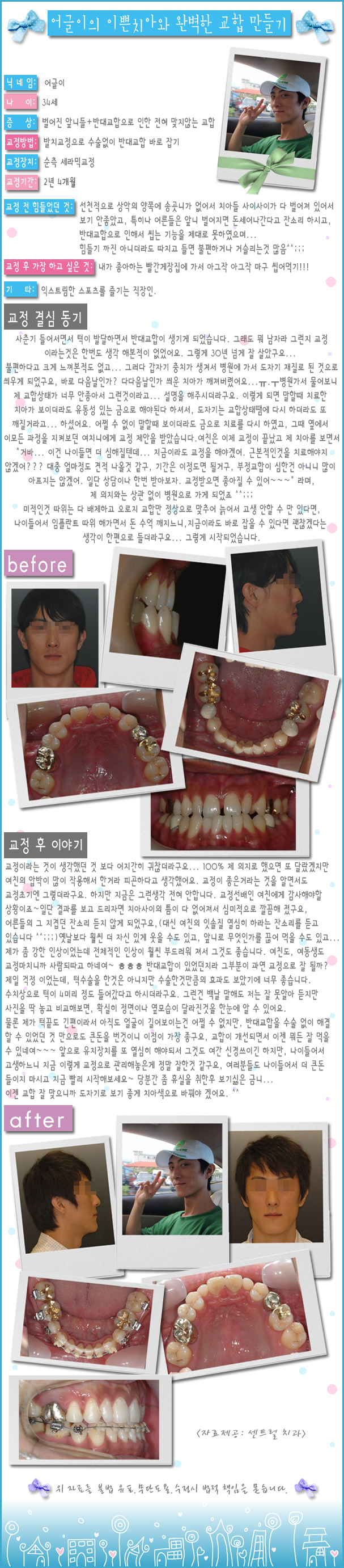 어글이.jpg