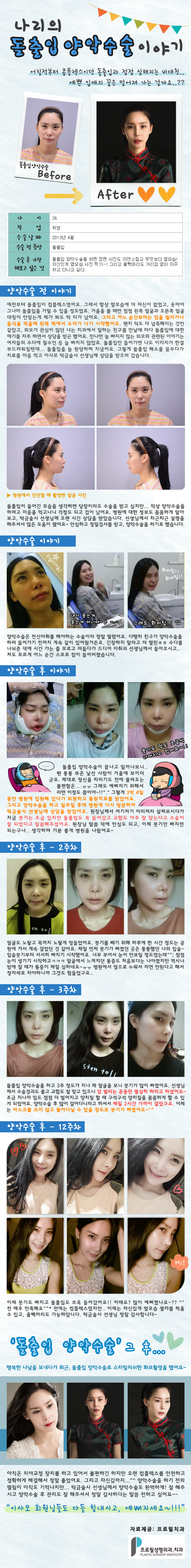 나리의돌출입양악수술이야기_140509.png