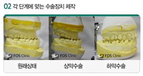 선수술과정_3.JPG