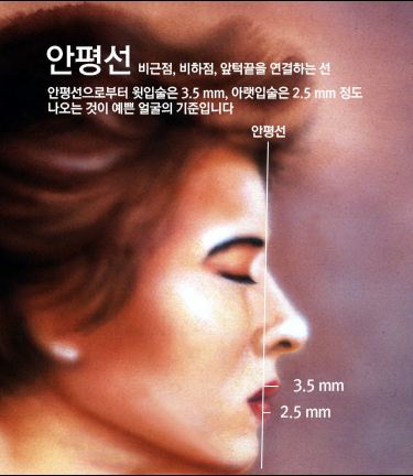 돌출입_2.JPG
