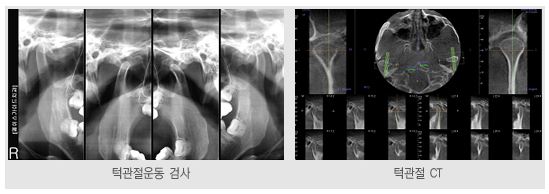 턱수술진단과정_4.JPG