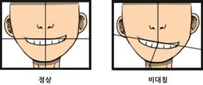 치아교정자가진단03.png