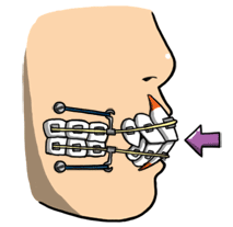 11.gif