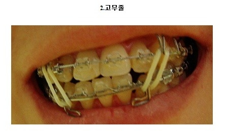 고무줄.jpg