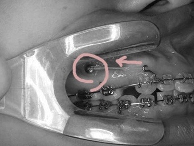 screw-2.jpg